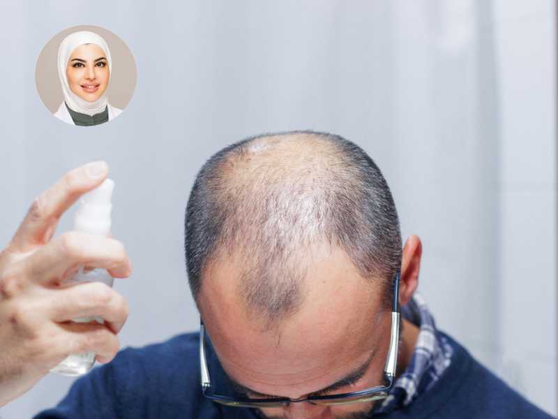 د. داليا صادق: تساقط الشعر قد يكون بسبب فرط التوتر او «الحميات القاسيه»