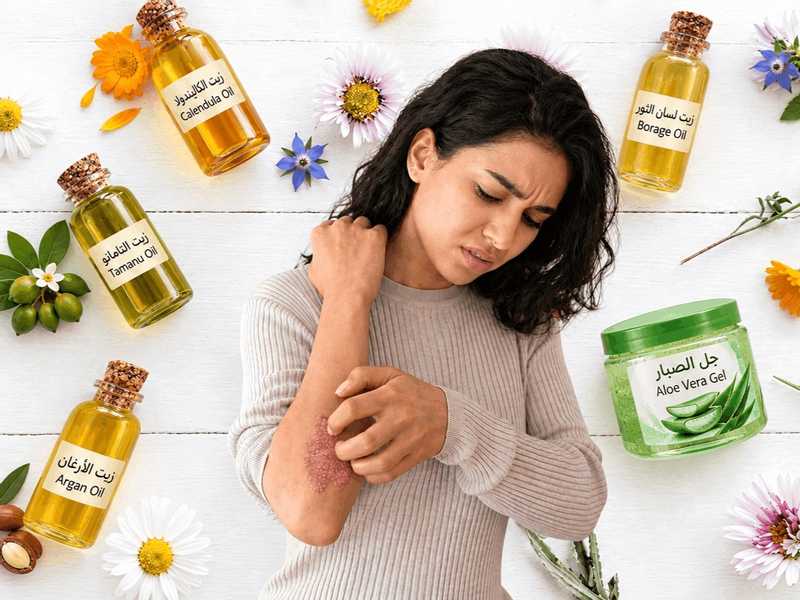 علاجات طبيعيه فعاله لمواجهه نوبات الصدفيه